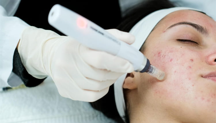 Advanced Laser Treatments