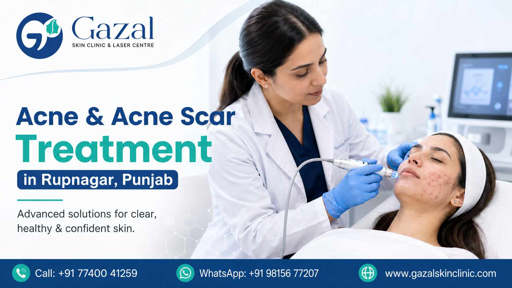 Acne & Acne Scar Treatment in Rupnagar, Punjab