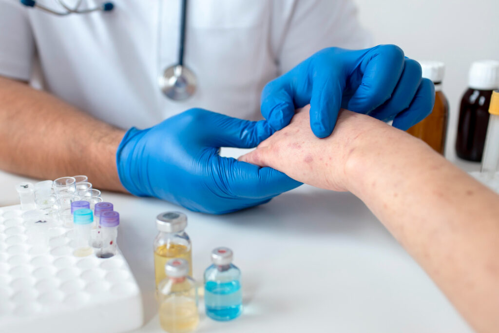 Fungal Infection Treatment​