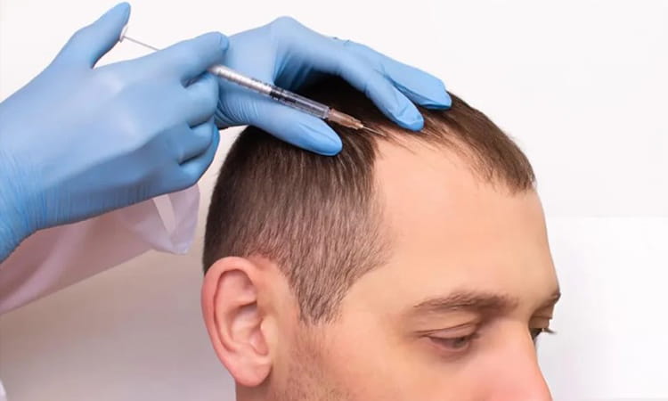 GFC Hair Treatment