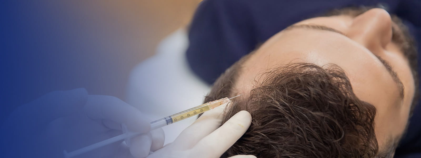 Hair Fall & Scalp Treatments in Ropar