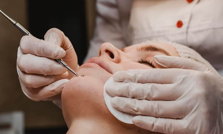 Open Pores Treatment