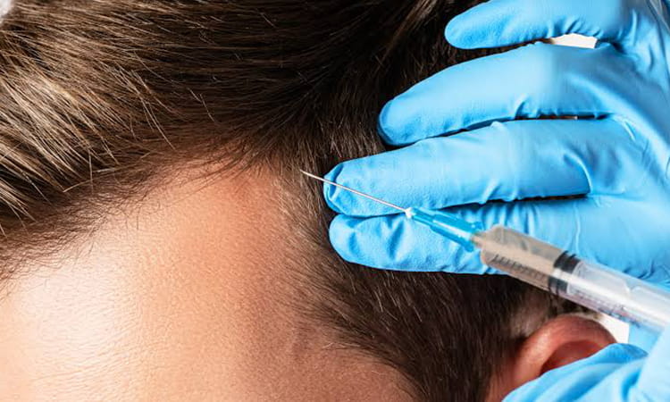PRP Treatment