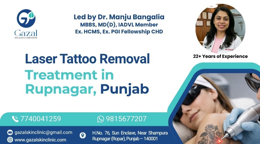 Laser Tattoo Removal Treatment in Rupnagar, Punjab