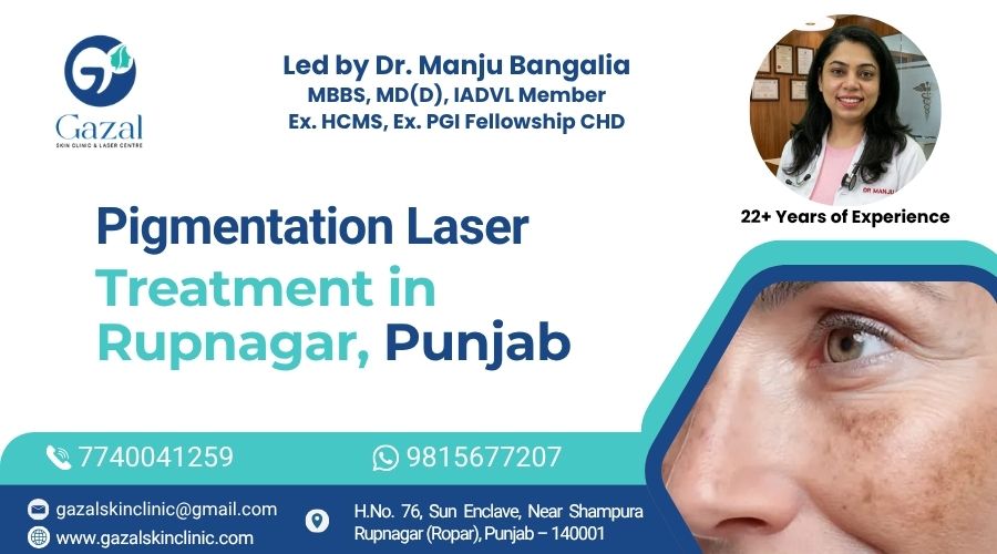 Pigmentation Laser Treatment in Rupnagar, Punjab
